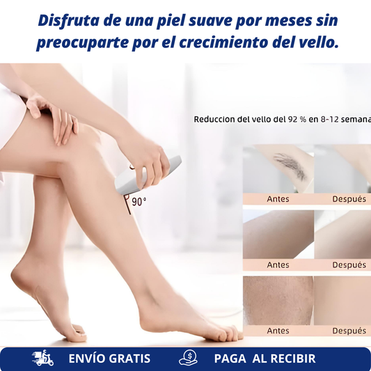 LaseBelle®-Depilador Laser Permanente IPL