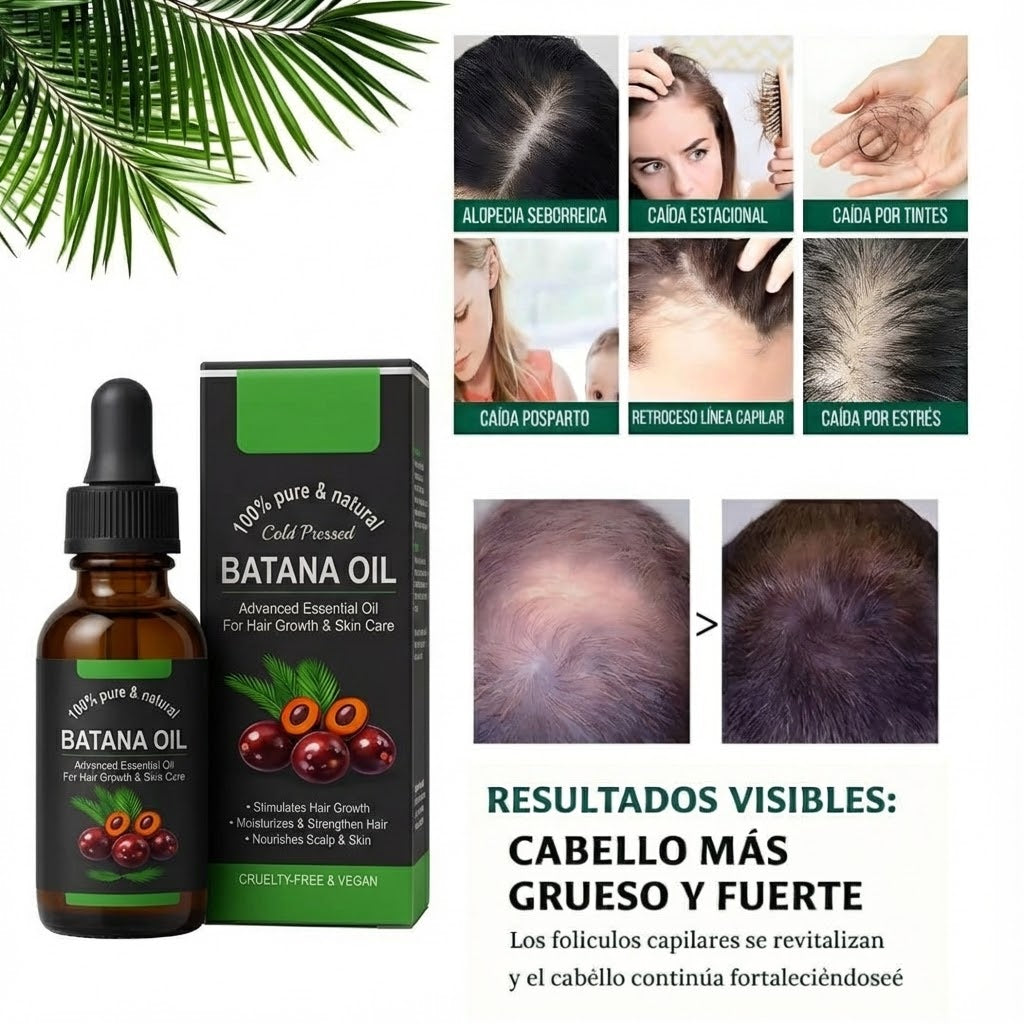 Aceite De Batana - Anti‑Hair Fall Oil